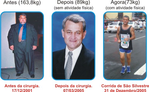 Antes / Depois e Hoje de Carrijo