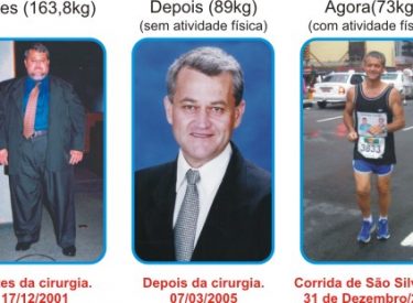 Antes / Depois e Hoje de Carrijo